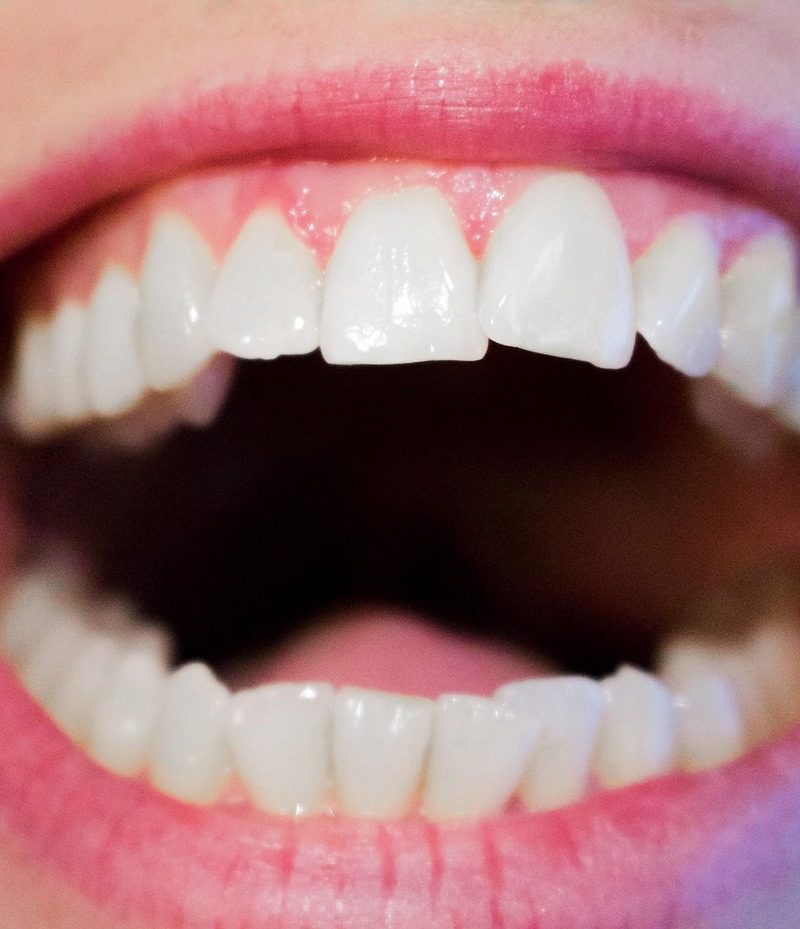 Nowoczesna technika stosowana w salonach stomatologii estetycznej może sprawić, że odbierzemy piękny uśmiech.